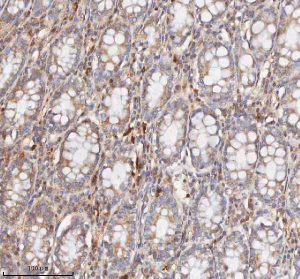  IHC analysis of CD127/IL7R using anti-CD127/IL7R antibody (A02222-3)