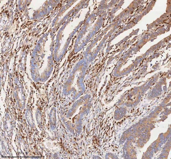 a02222 3 il7r primary antibodies ihc testing 4