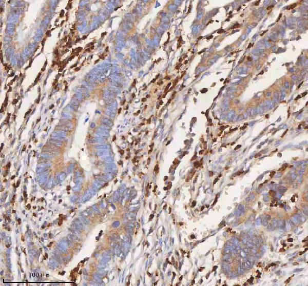 a02222 3 il7r primary antibodies ihc testing 5