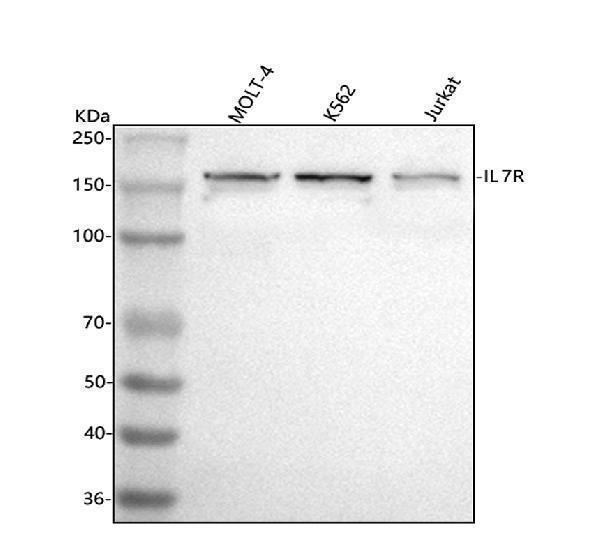  Western blot analysis of CD127/IL7R using anti-CD127/IL7R antibody (A02222-3)