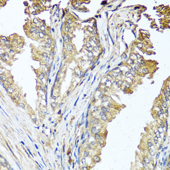 Immunofluorescence analysis of NIH-3T3 cells using STK3/MST2 Polyclonal Antibody  at dilution of 1:100 