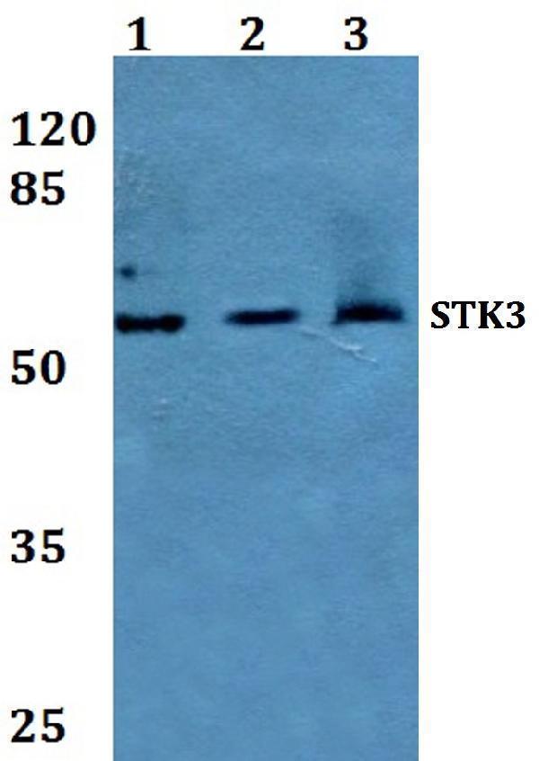 Western blot (WB) analysis of STK3 polyclonal antibody at 1:500 dilution
Lane1:Hela whole cell lysate
Lane2:Raw264