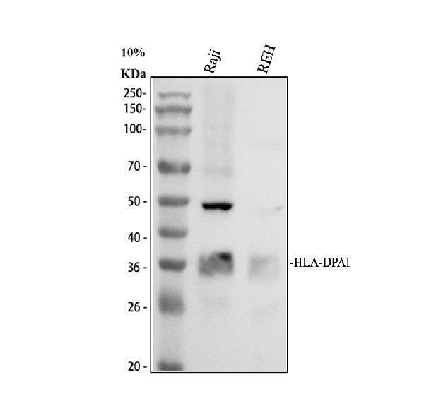 Western blot analysis of HLA-DPA1 using anti-HLA-DPA1 antibody (A02225-1)