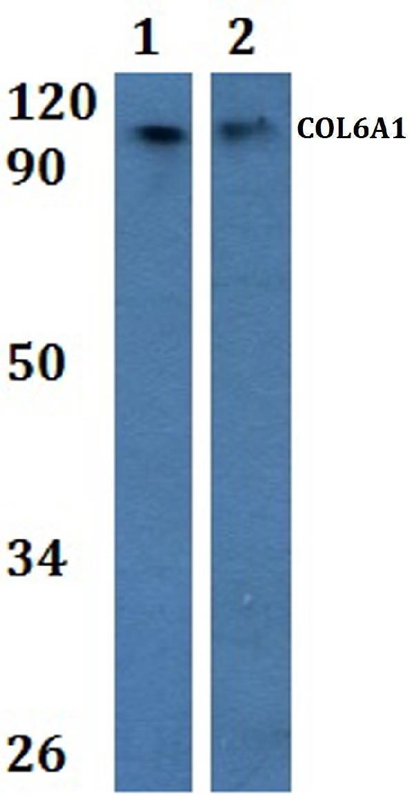 Western blot (WB) analysis of COL6A1 polyclonal antibody at 1:500 
Lane1:Hela whole cell lysate
Lane2:H9C2 whole cell lysate