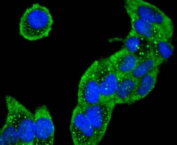 ICC staining Collagen VI in Hela cells (green)