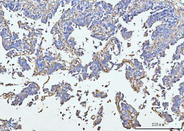  IHC analysis of COL6A1 using anti-COL6A1 antibody (A02226-5)