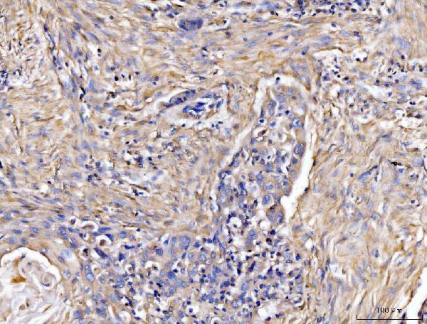  IHC analysis of COL6A1 using anti-COL6A1 antibody (A02226-5)