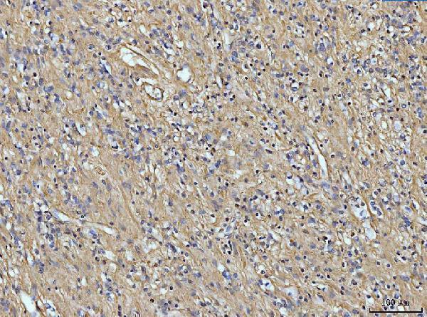 a02226 5 col6a1 primary antibodies ihc testing 4