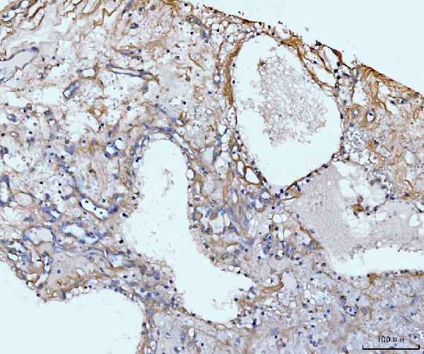 a02226 5 col6a1 primary antibodies ihc testing 5
