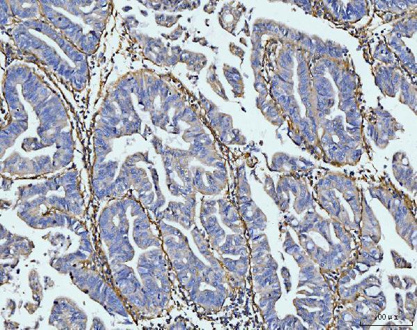 a02226 5 col6a1 primary antibodies ihc testing 6