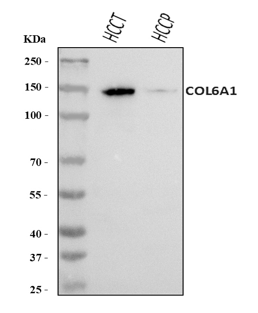  Western blot analysis of COL6A1 using anti-COL6A1 antibody (A02226-5)