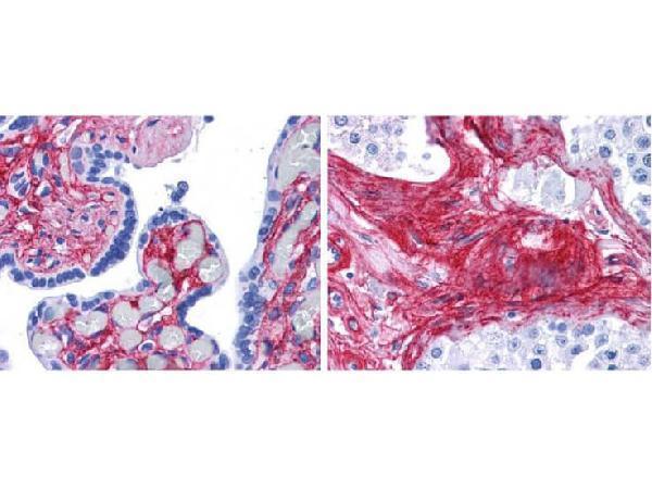 a02226 collagen iv primary antibodies ihc testing 1_1
