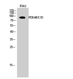 Western blotting validation for Anti-PDE4B/C/D Antibody A02228

Electrophoresis was performed on a SDS-PAGE gel