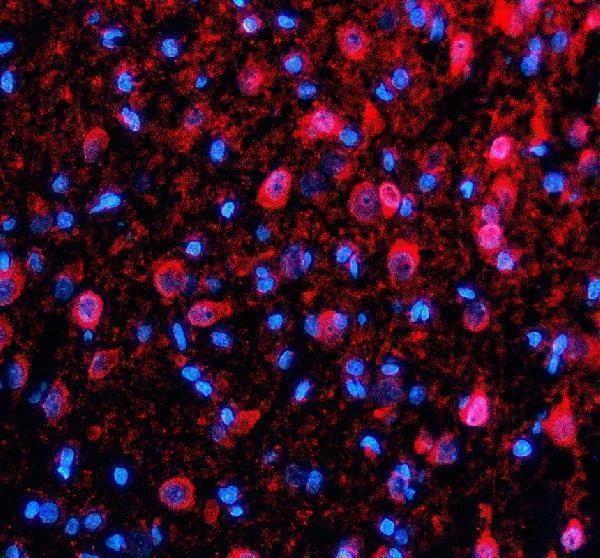 a02231 2 tdp1 primary antibodies if testing 2