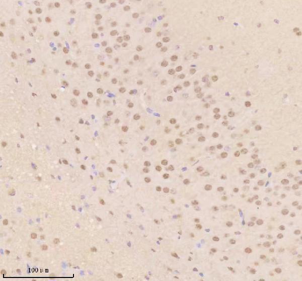 IHC analysis of TDP1 using anti-TDP1 antibody (A02231-2)