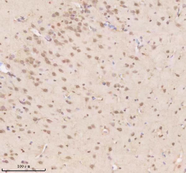 IHC analysis of TDP1 using anti-TDP1 antibody (A02231-2)