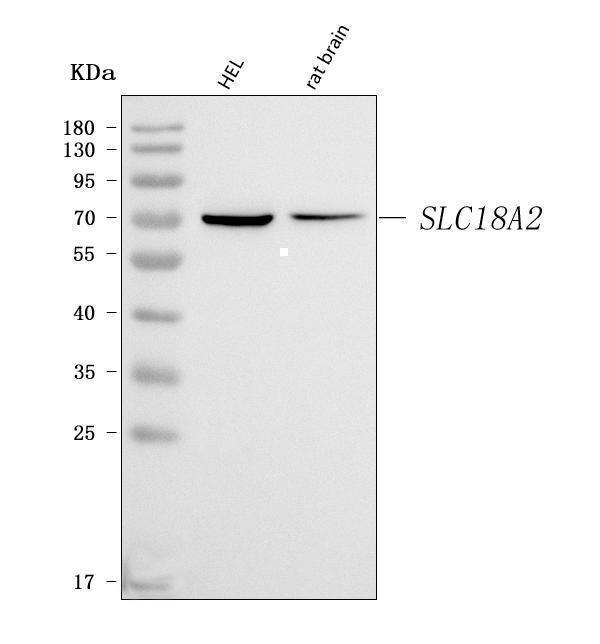  Western blot analysis of VMAT2/SLC18A2 using anti-VMAT2/SLC18A2 antibody (A02232-1)