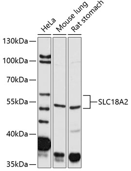 a02232 slc18a2 primary antiboties wb testing 1
