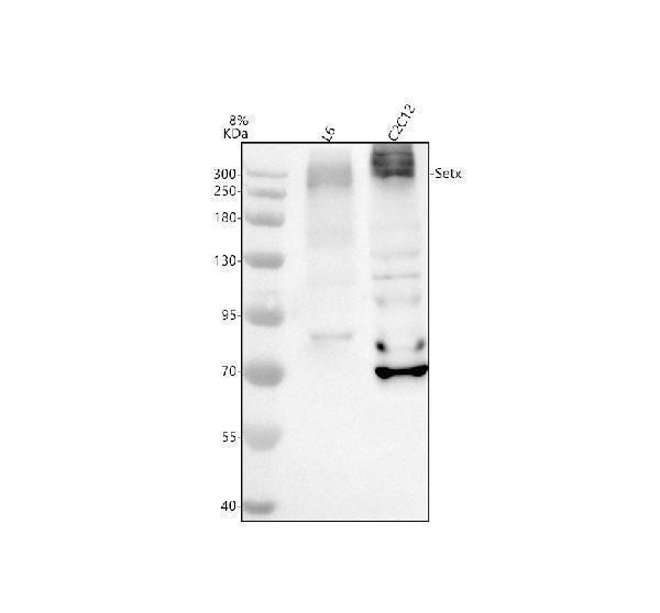 Western blot analysis of SETX using anti-SETX antibody (A02233-2)