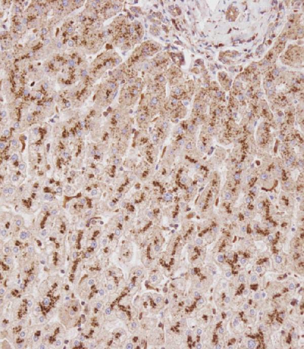 a02234 anti gusb antibody center ihc p testing 2