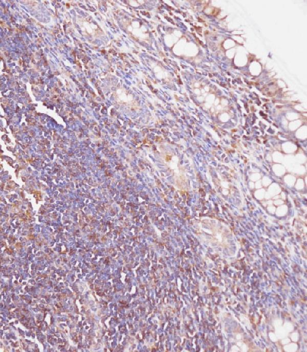 a02234 anti gusb antibody center ihc p testing 3