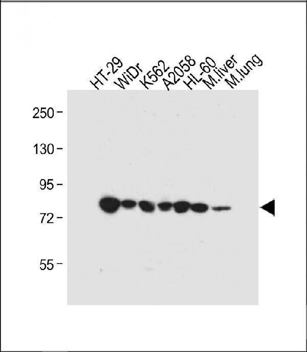 a02234 anti gusb antibody center wb testing 1