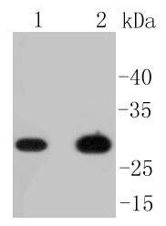 Western blot analysis of CD8 alpha on different lysates using anti-CD8 alpha antibody at 1/1,000 dilution