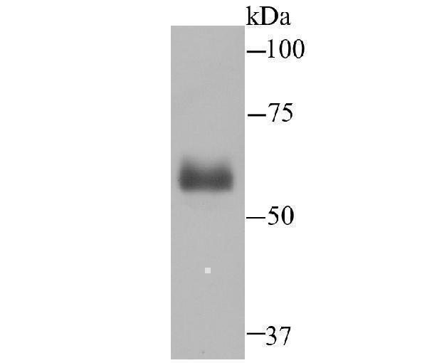 a02237 1 hpx primary antiboties wb testing 1