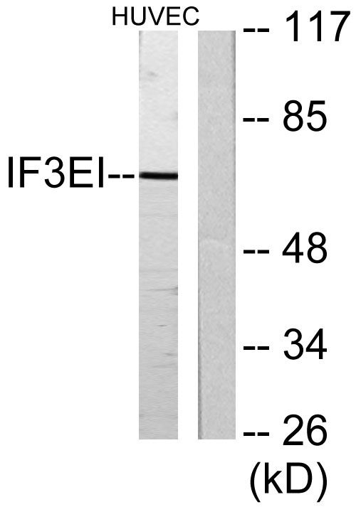 Western blot analysis of lysates from HUVEC cells, using IF3EI Antibody