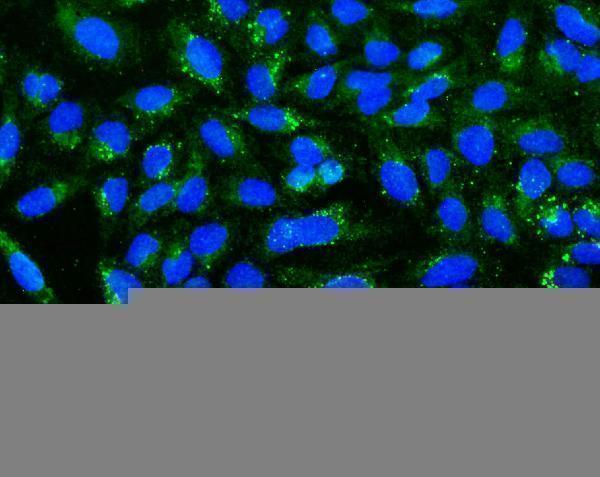 a02239 1 ugt1a6 primary antibodies if testing 2_1