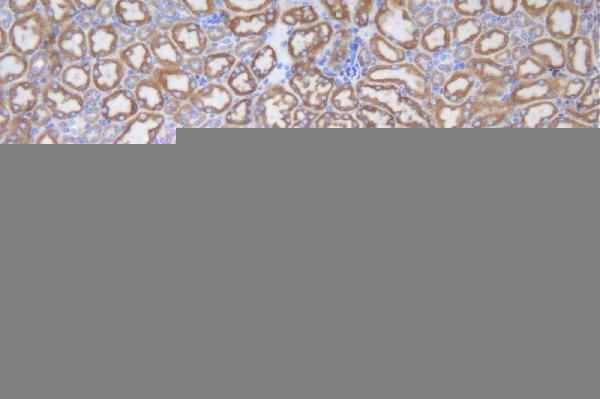 a02239 2 ugt1a6 primary antibodies ihc testing 2