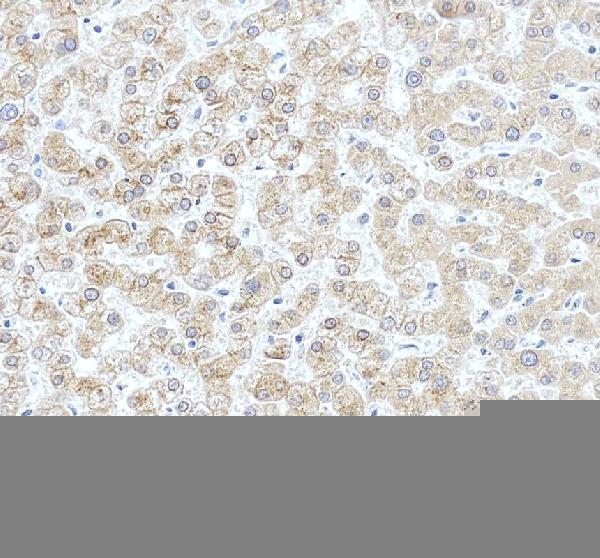 a02239 2 ugt1a6 primary antibodies ihc testing 3