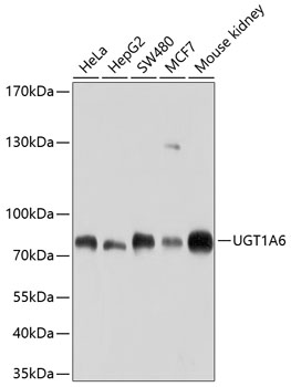 a02239 ugt1a6 primary antiboties wb testing 1