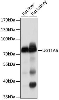 a02239 ugt1a6 primary antiboties wb testing 2