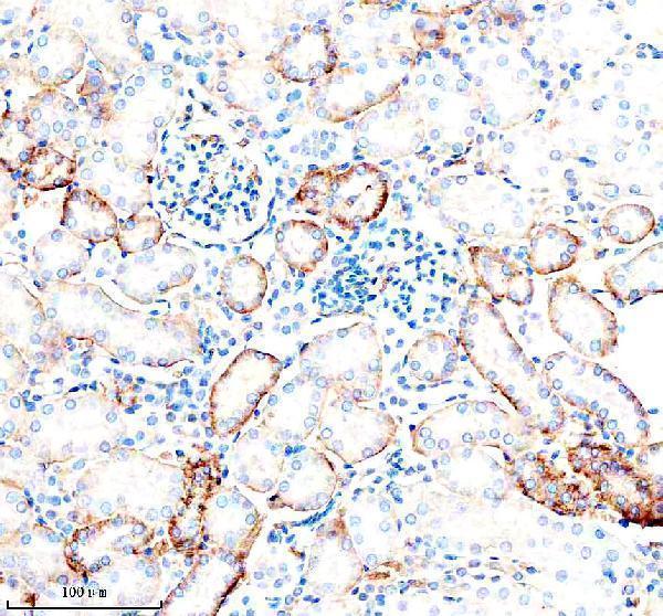a02240 1 mct1 slc16a1 primary antibodies ihc testing 2