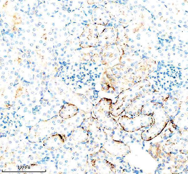 a02240 1 mct1 slc16a1 primary antibodies ihc testing 3
