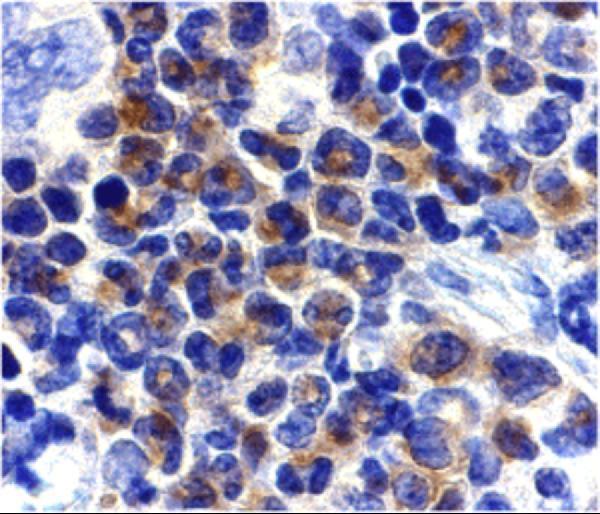 a02241 dapk2 primary antibodies ihc testing 2