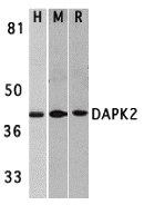 a02241 dapk2 primary antibodies wb testing 1