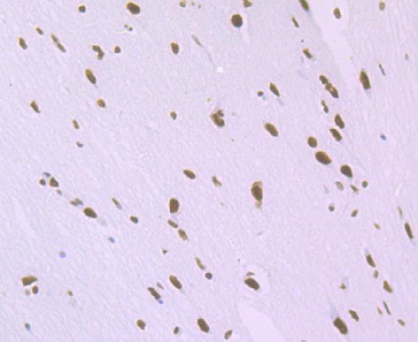 Immunohistochemical analysis of paraffin-embedded rat brain tissue using anti-SFPQ antibody