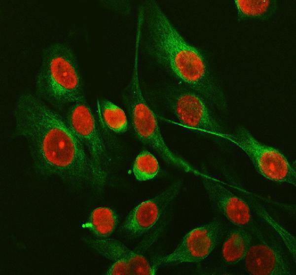a02243 2 sfpq primary antibodies if testing 3