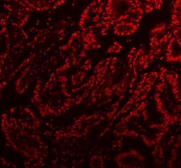a02243 2 sfpq primary antibodies if testing 5