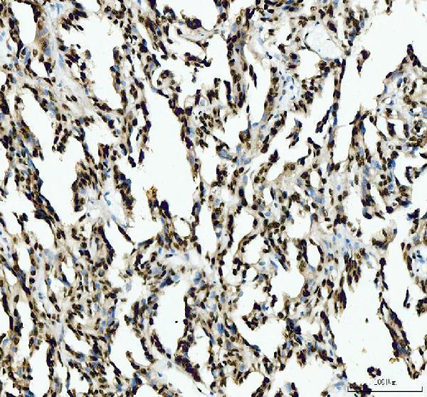 IHC analysis of SFPQ using anti-SFPQ antibody (A02243-2)
