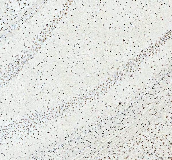 a02243 2 sfpq primary antibodies ihc testing 10
