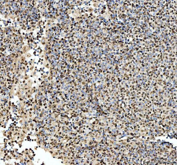 IHC analysis of SFPQ using anti-SFPQ antibody (A02243-2)