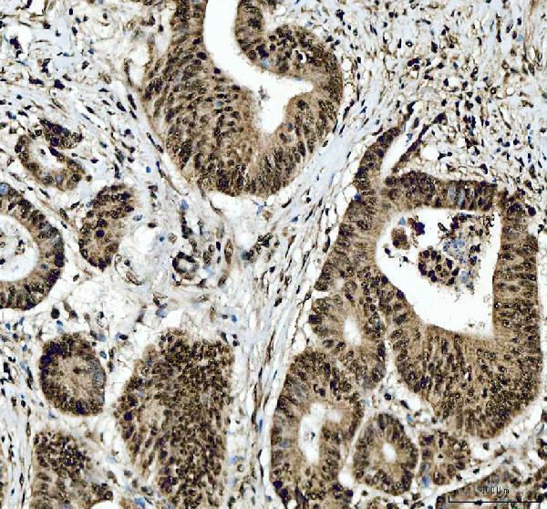 a02243 2 sfpq primary antibodies ihc testing 4_1
