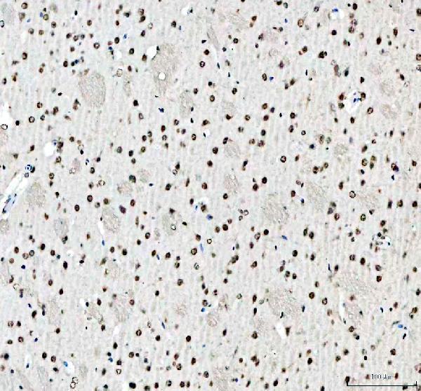 a02243 2 sfpq primary antibodies ihc testing 8