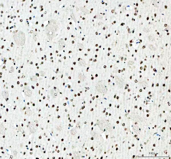 a02243 2 sfpq primary antibodies ihc testing 9