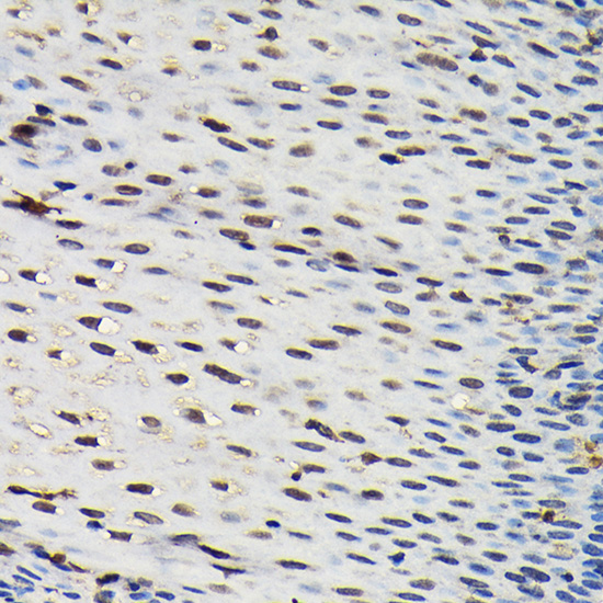 Immunohistochemistry of paraffin-embedded human esophageal using SFPQ Rabbit pAb  at dilution of 1:25 