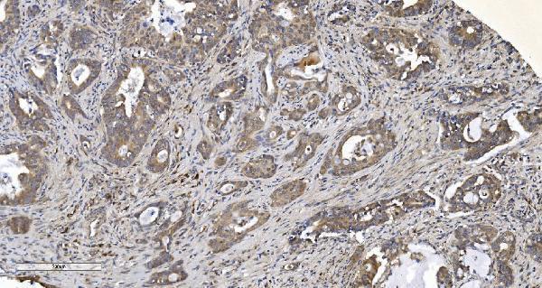 a02244 1 arg2 primary antibodies ihc testing 5