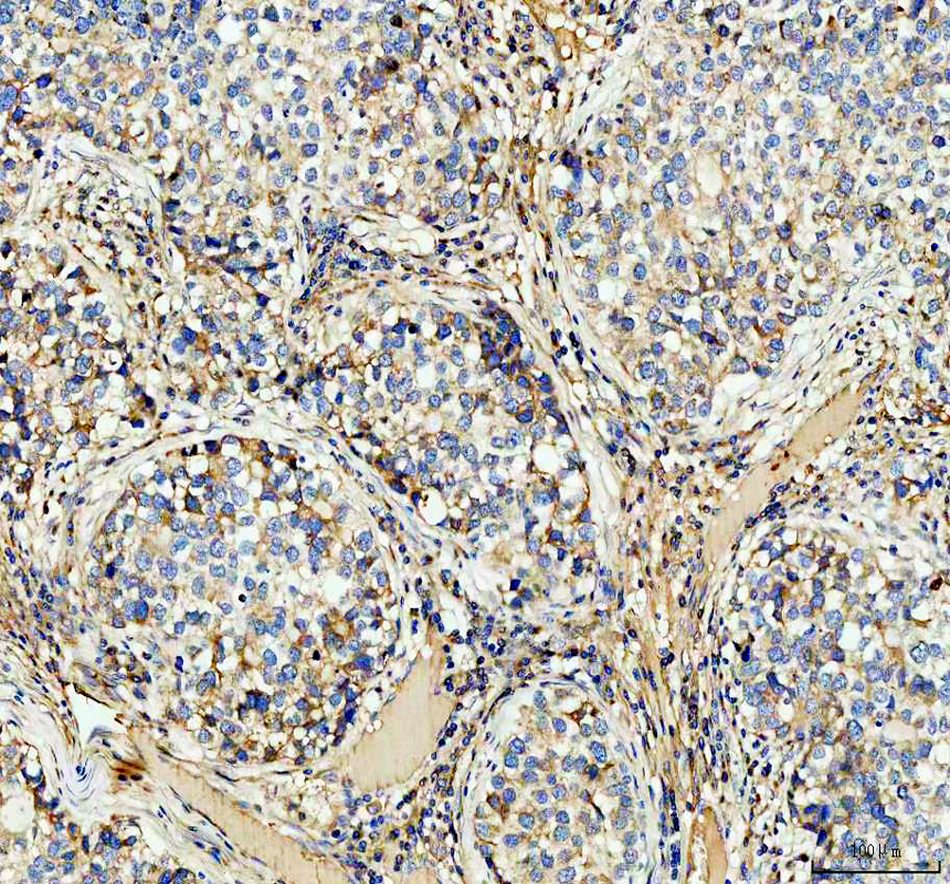 IHC analysis of ARG2 using anti-ARG2 antibody (A02244)